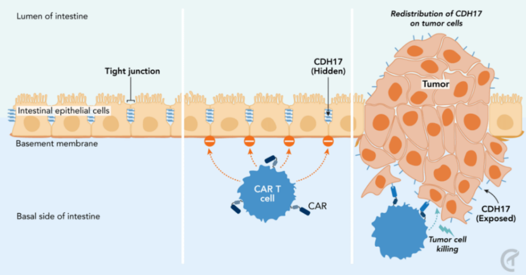 全球首款 CDH17 靶向 CAR-T 在美国获批开展临床试验