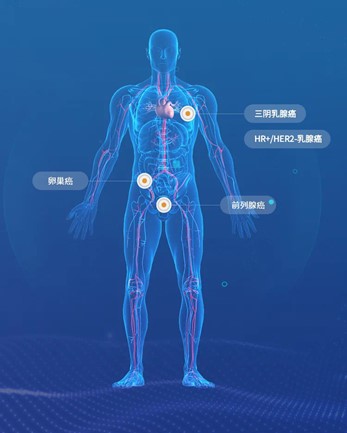 FDA批准LAE002（Afuresertib）PLUS LAE001治疗前列腺癌的III期临床试验方案